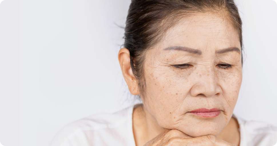 Melasma and Freckles